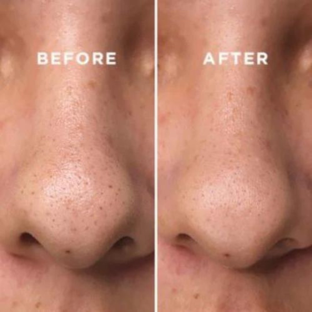 COSRX BHA Blackhead Power Liquid